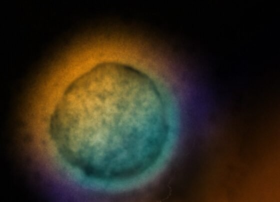 Vírus Nipah, partículas, célula