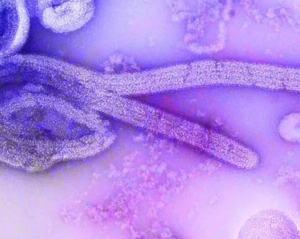 ebola